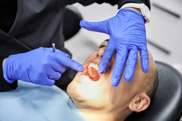 Best Emergency Tooth Extraction in Oakland, TN